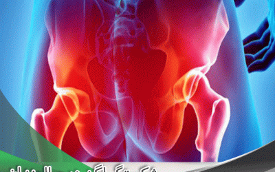 شکستگی لگن می تواند منجر به مرگ شود؟