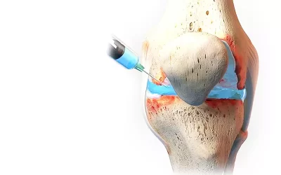 باورهای غلط در مورد آمپول غضروف ساز