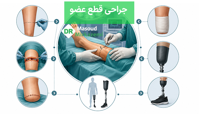 جراحی قطع عضو