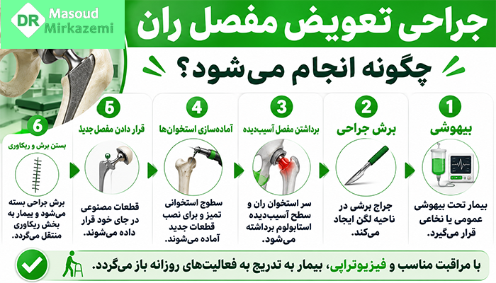 تعویض مفصل ران چگونه انجام میشود؟