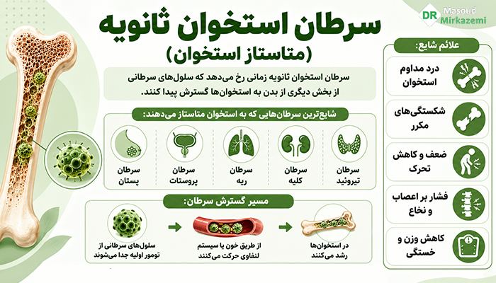 سرطان استخوان ثانویه