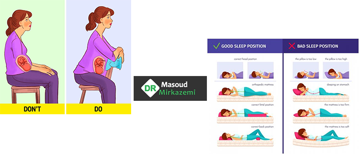 درمان کمر درد در بارداری