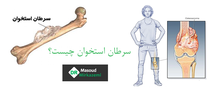 سرطان استخوان چیست؟