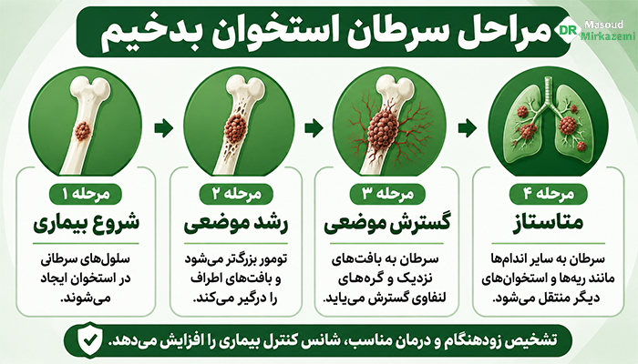 مراحل سرطان استخوان بدخیم