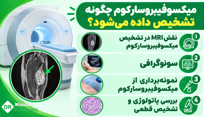 میکسوفیبروسارکوم چگونه تشخیص داده میشود؟