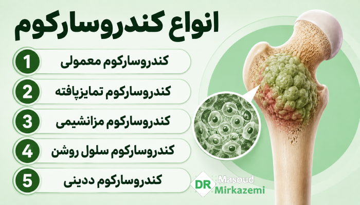 انواع کندروسارکوم کداماند؟