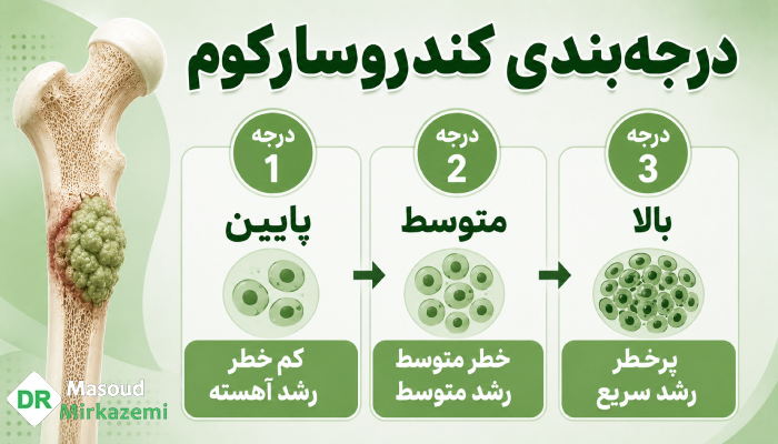 درجهبندی کندروسارکوم