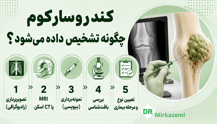 کندروسارکوم چگونه تشخیص داده میشود؟