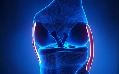 فیزیوتراپی بعد از عمل استئوتومی زانو + نکات مهم