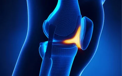 هزینه جراحی استئوتومی زانو در سال 1404