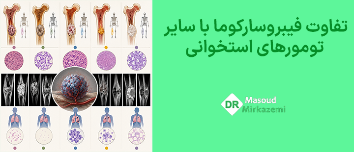 تفاوت فیبروسارکوما با سایر تومورهای استخوانی