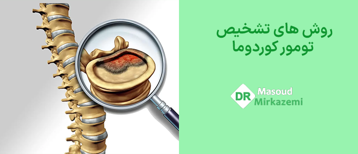 روش های تشخیص تومور کوردوما