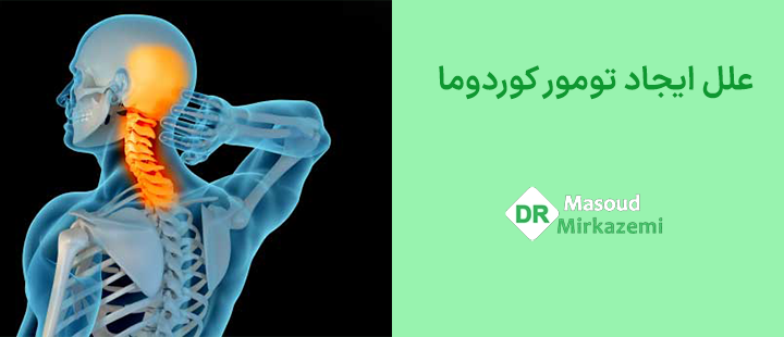 علل ایجاد تومور کوردوما