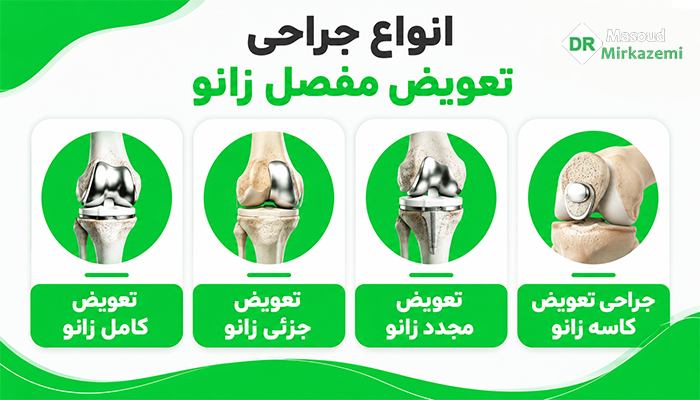 انواع جراحی تعویض مفصل زانو