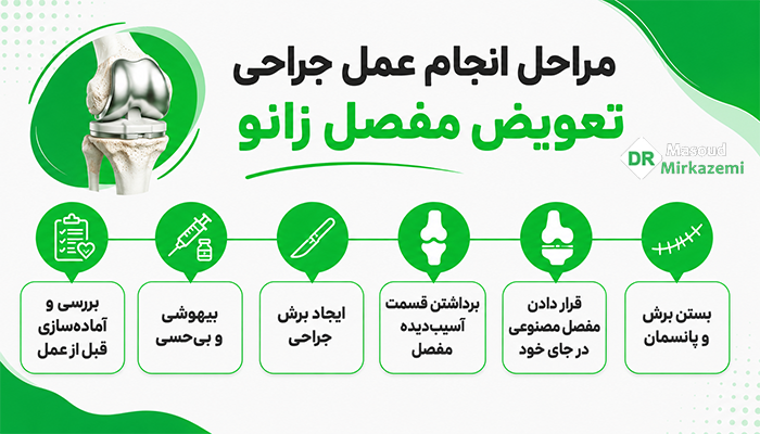 مراحل انجام تعویض مفصل زانو